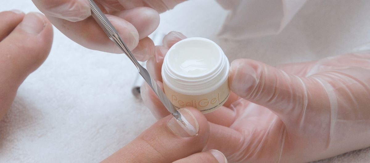 Nagelkorrekturen mit Spangentechnik & Prothetik