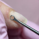 The Curette