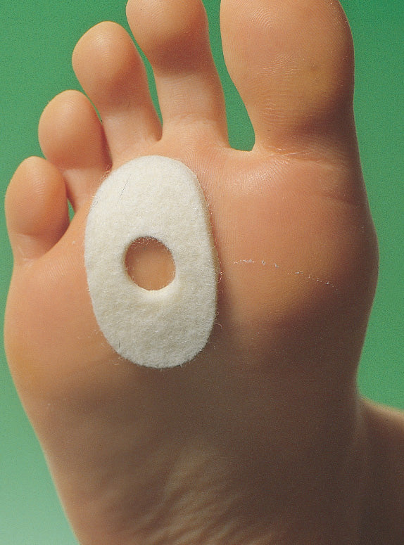 Ballenring oval